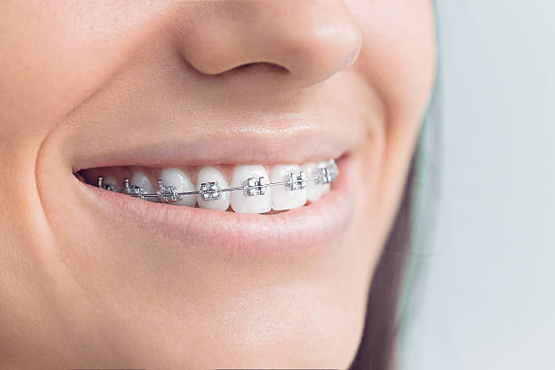 Best Wisdom Tooth Removal  in Rden City, GA